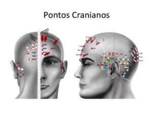 Pontos Cranianos